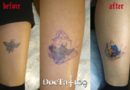 Cover-up tattoo